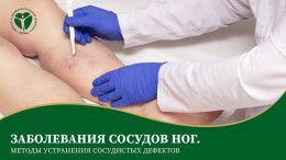 Заболевания сосудов ног. Методы устранения сосудистых дефектов Заболевания сосудов ног. Методы устранения сосудистых дефектов